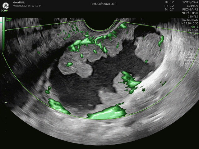 Preoperative risk assessment and US reporting