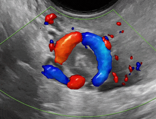 Normal findings and non-neolpastic lesions